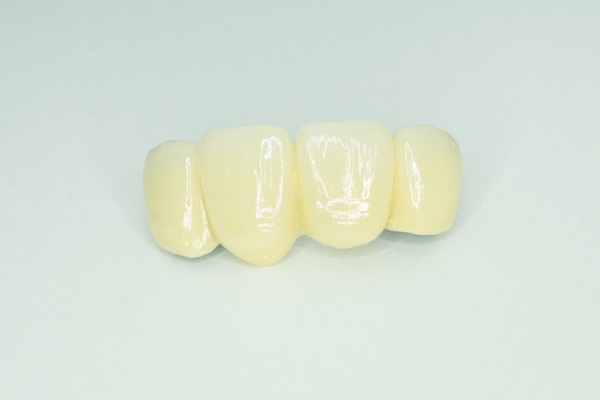 How To Tell If You Are A Candidate For A Dental Bridge