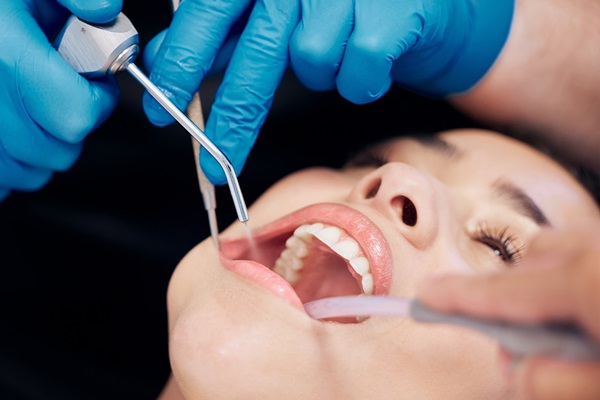 Benefits Of Regular General Dentistry Dental Cleanings