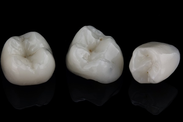 The Versatile Uses Of Dental Crowns