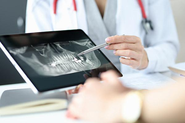The Importance of Regular Dental Checkup X-Rays from 608 Family Dental in Sun Prairie, WI